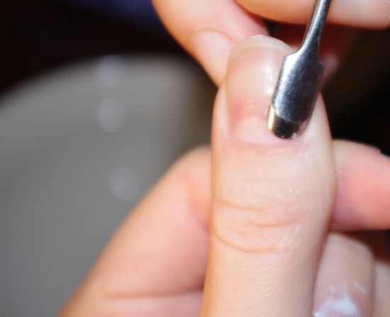 Cuticle eltávolítás