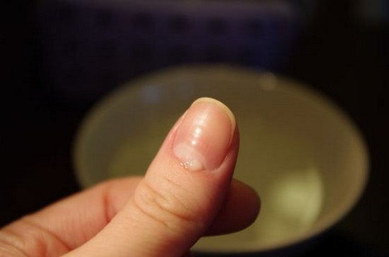 Cuticle eltávolítás