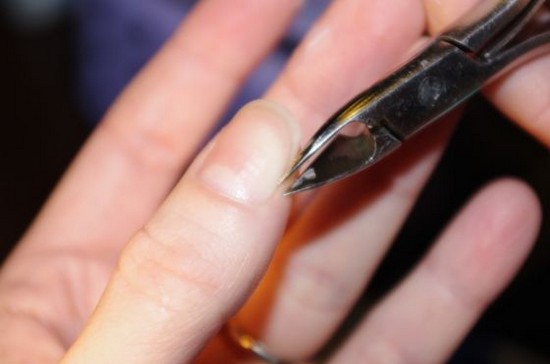 Cuticle eltávolítás