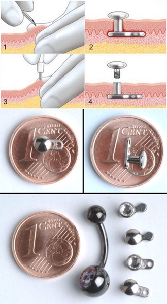 Mikrodermális piercing: mikrodermabrák készítése (fotó)
