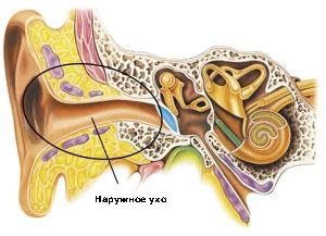 Hogyan kezeljük az otitis-ot az otthonban?