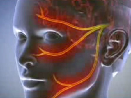 Neuralgia: tünetek, fotók, kezelés