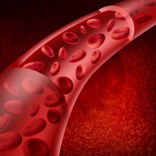 Vasculitis - mi ez? Tünetek, fotók, kezelés